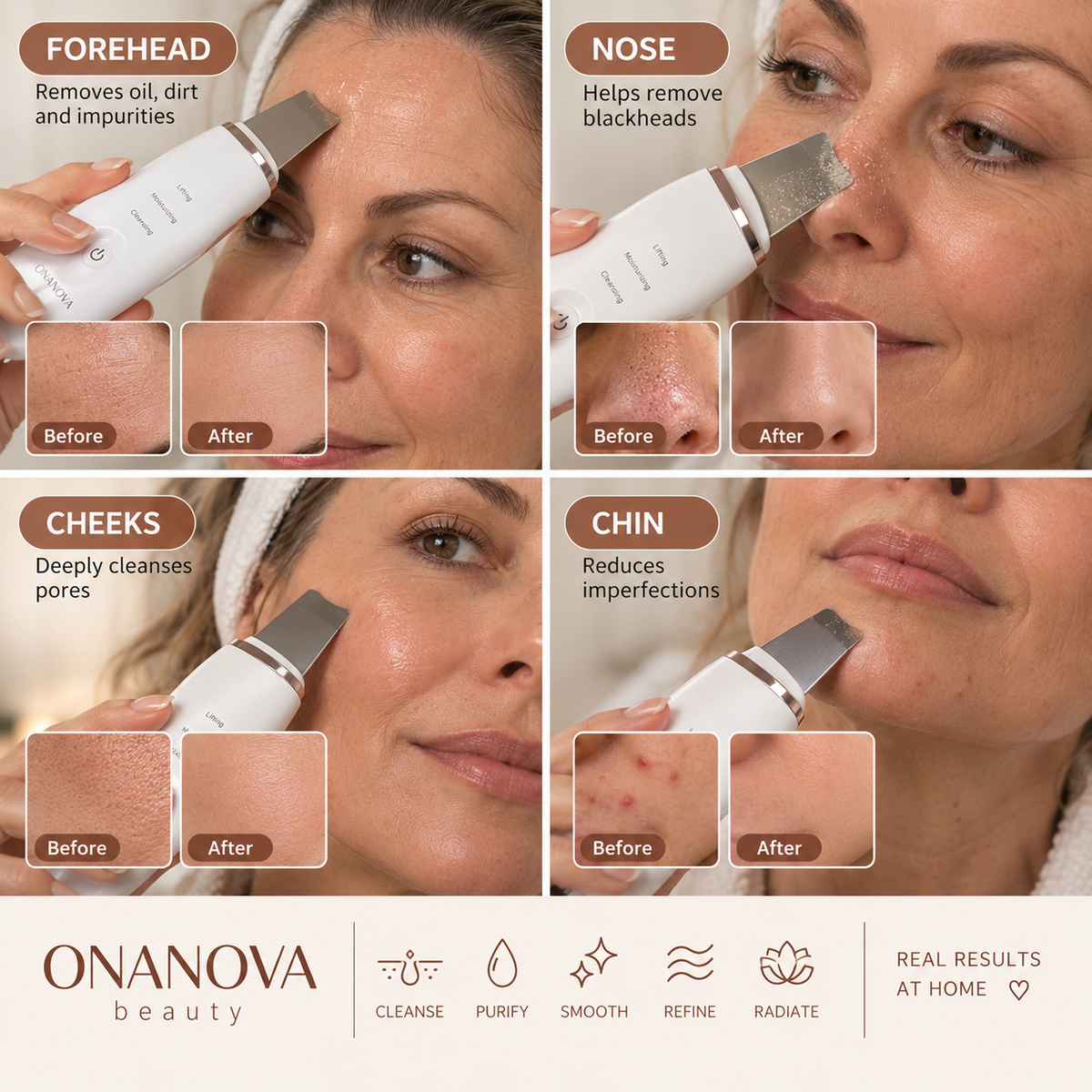 Beauty Skin Spatula© Onanova